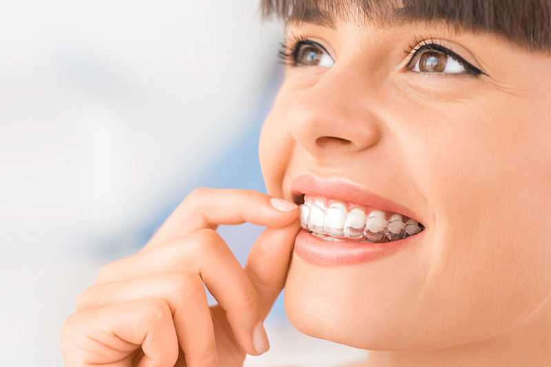 Invisalign in Taunton